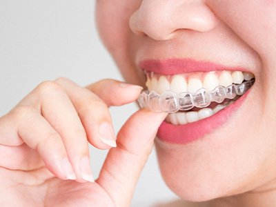 A smiling woman placing Invisalign trays in her mouth