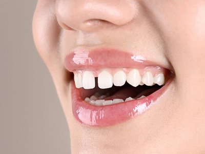 A woman with a gap between her front teeth
