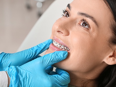 A closeup of a woman with braces receiving dental care