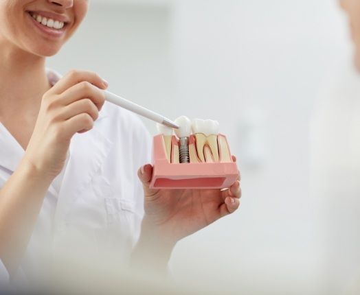 Dentist pointing to dental implant model