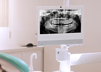 digital radiography