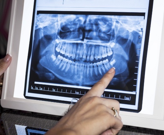 Dentist looking at digital dental x-rays