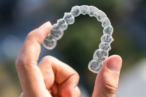 Closeup of Invisalign aligner 