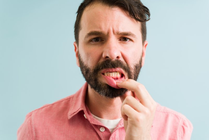 A young man with the first stage of gum disease